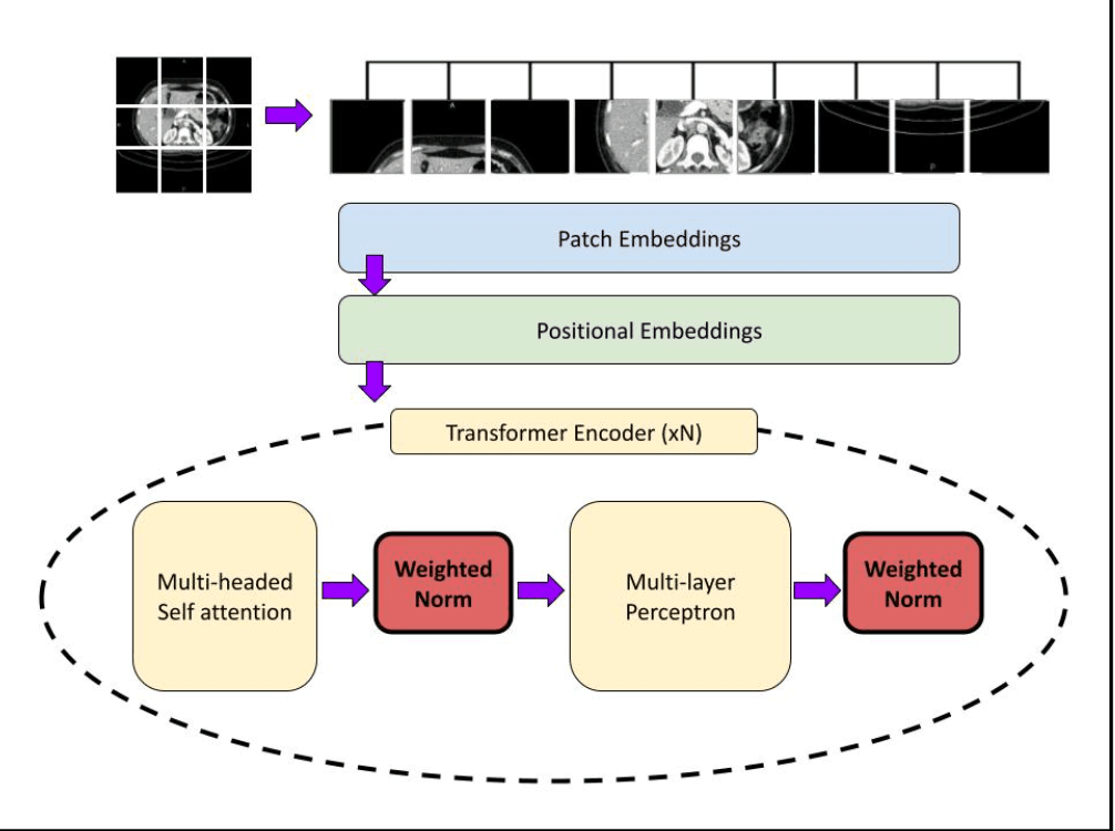 Pancreatic Cancer Imaging Research project visual